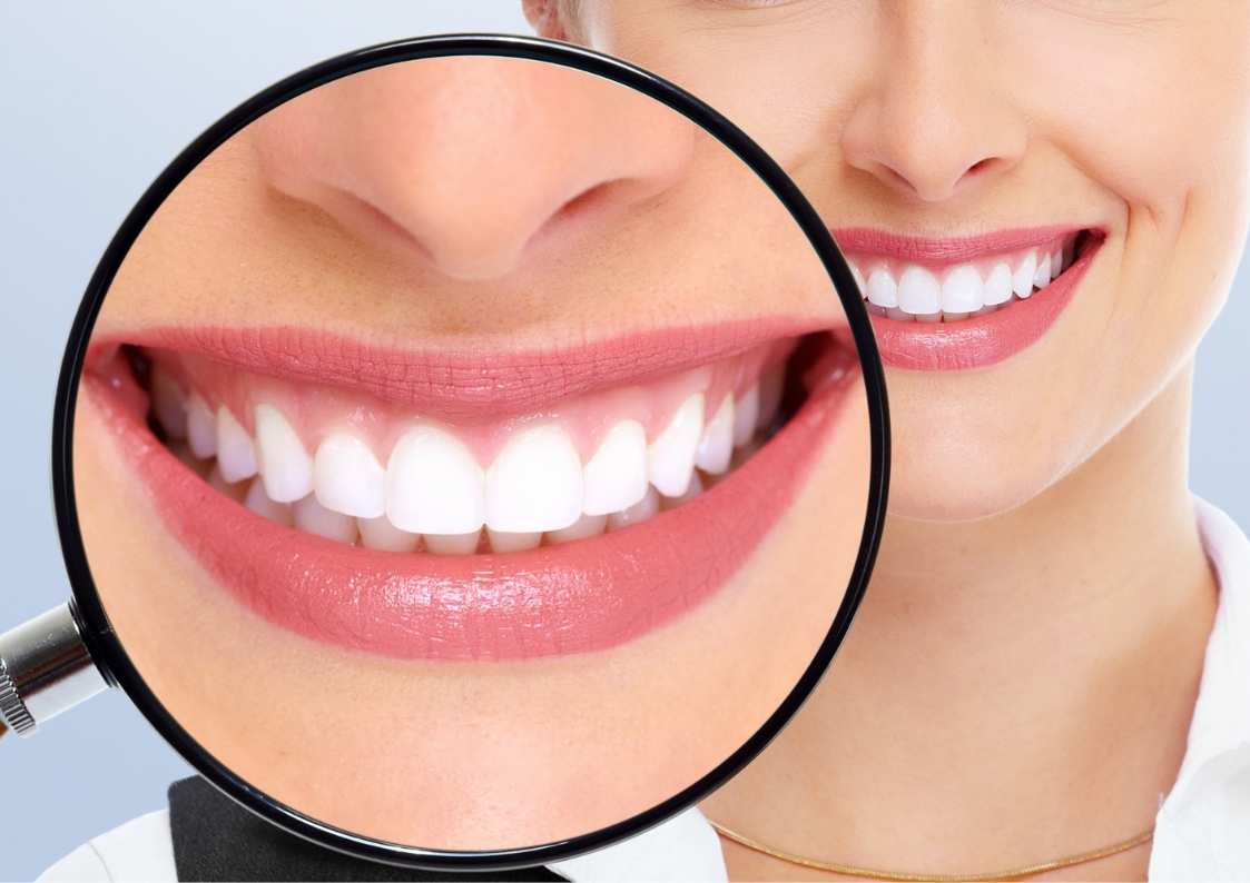 חיוך של מיליון דולר: איך משפרים את מראה השיניים?