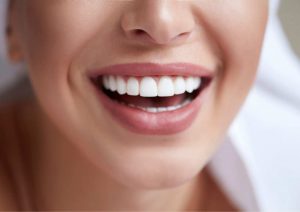 חיוך של מיליון דולר: איך משפרים את מראה השיניים?